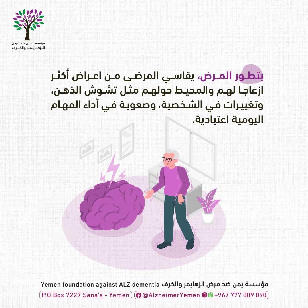 تطورات مرض الزهايمر